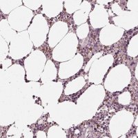 Anti-CHIT1 antibody produced in rabbit 