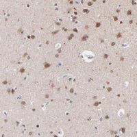 Anti-CHM antibody produced in rabbit 