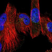 Anti-CHST11 antibody produced in rabbit 
