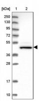 Anti-CHST12 antibody produced in rabbit 