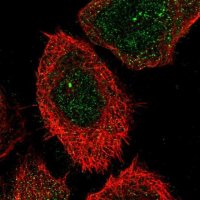 Anti-CHST15 antibody produced in rabbit 