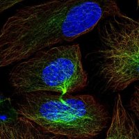 Anti-CISH antibody produced in rabbit 