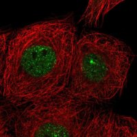 Anti-CIZ1 antibody produced in rabbit 