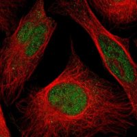Anti-CLP1 antibody produced in rabbit 