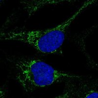 Anti-CMC4 antibody produced in rabbit 