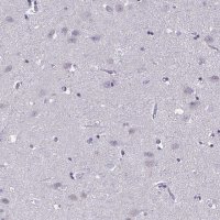 Anti-CNGB3 antibody produced in rabbit 