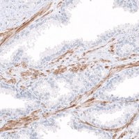 Anti-COL14A1 antibody produced in rabbit HPA023781-100UL
