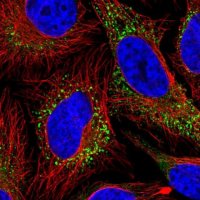 Anti-COL5A1 antibody produced in rabbit 