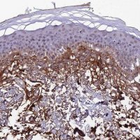 Anti-COL6A6 antibody produced in rabbit 