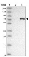 Anti-COLGALT1 antibody produced in rabbit 