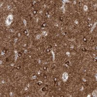 Anti-CPNE5 antibody produced in rabbit 