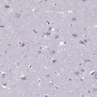 Anti-CRB2 antibody produced in rabbit 