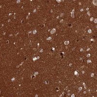 Anti-CRBN antibody produced in rabbit 