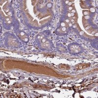 Anti-CRHBP antibody produced in rabbit 