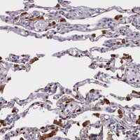 Anti-CRIP1 antibody produced in rabbit 