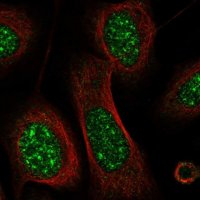 Anti-CRIP3 antibody produced in rabbit HPA036198-100UL