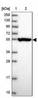 Anti-CRTAP antibody produced in rabbit 