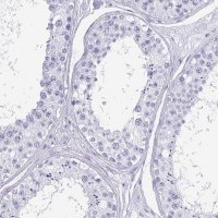 Anti-CRYBB2 antibody produced in rabbit 