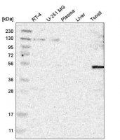 Anti-CSRNP2 antibody produced in rabbit 