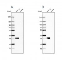 Anti-CT45A1 antibody produced in rabbit HPA046872-100UL
