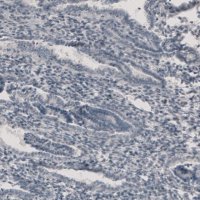 Anti-CT83 antibody produced in rabbit 