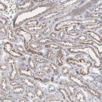 Anti-CTAGE5 antibody produced in rabbit 