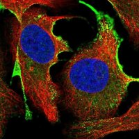 Anti-CTDSPL antibody produced in rabbit 