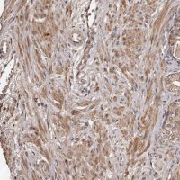 Anti-CTGF antibody produced in rabbit 