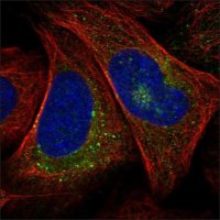 Anti-CTGF antibody produced in rabbit HPA031074-100UL