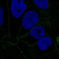 Anti-CTNNA1 antibody produced in rabbit HPA046119-100UL