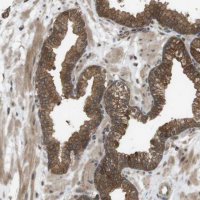 Anti-CTPS2 antibody produced in rabbit 