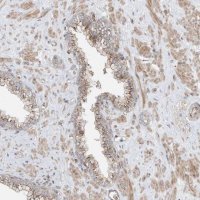 Anti-CUX1 antibody produced in rabbit 