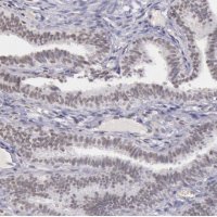 Anti-CXorf21 antibody produced in rabbit 