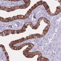 Anti-CXORF57 antibody produced in rabbit 