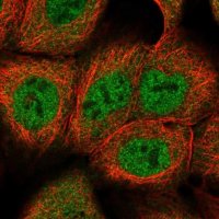 Anti-DCAF8 antibody produced in rabbit 