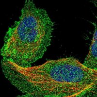 Anti-DCBLD2 antibody produced in rabbit 