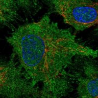 Anti-DCHS1 antibody produced in rabbit 