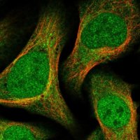 Anti-DCTD antibody produced in rabbit 