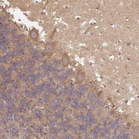 Anti-DCTN1 antibody produced in rabbit HPA034635-100UL