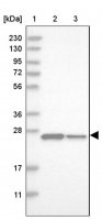 Anti-DCTN6 antibody produced in rabbit 
