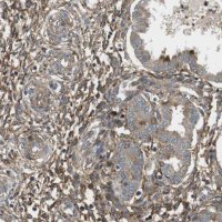 Anti-DDAH2 antibody produced in rabbit HPA012509-100UL