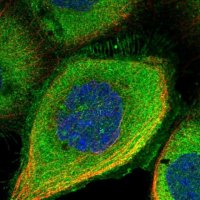 Anti-DDIAS antibody produced in rabbit 