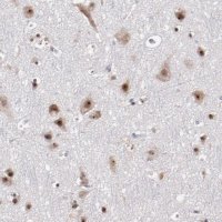 Anti-DDX24 antibody produced in rabbit 