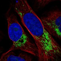 Anti-DDX49 antibody produced in rabbit 