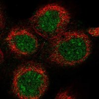 Anti-DDX51 antibody produced in rabbit 