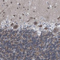 Anti-DDX56 antibody produced in rabbit HPA019749-100UL