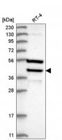 Anti-DEDD antibody produced in rabbit HPA030681-100UL