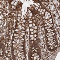 Anti-DHDDS antibody produced in rabbit 
