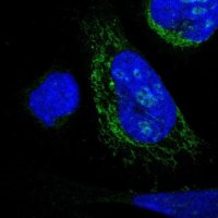 Anti-DHRS3 antibody produced in rabbit 