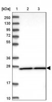 Anti-DHRS9 antibody produced in rabbit HPA036667-100UL